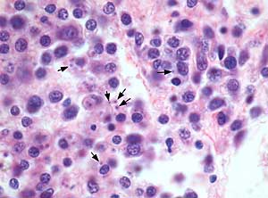 Microfotografía de hemocitos de ostra plana infectada con Bonamia sp (indicado por flechas).
